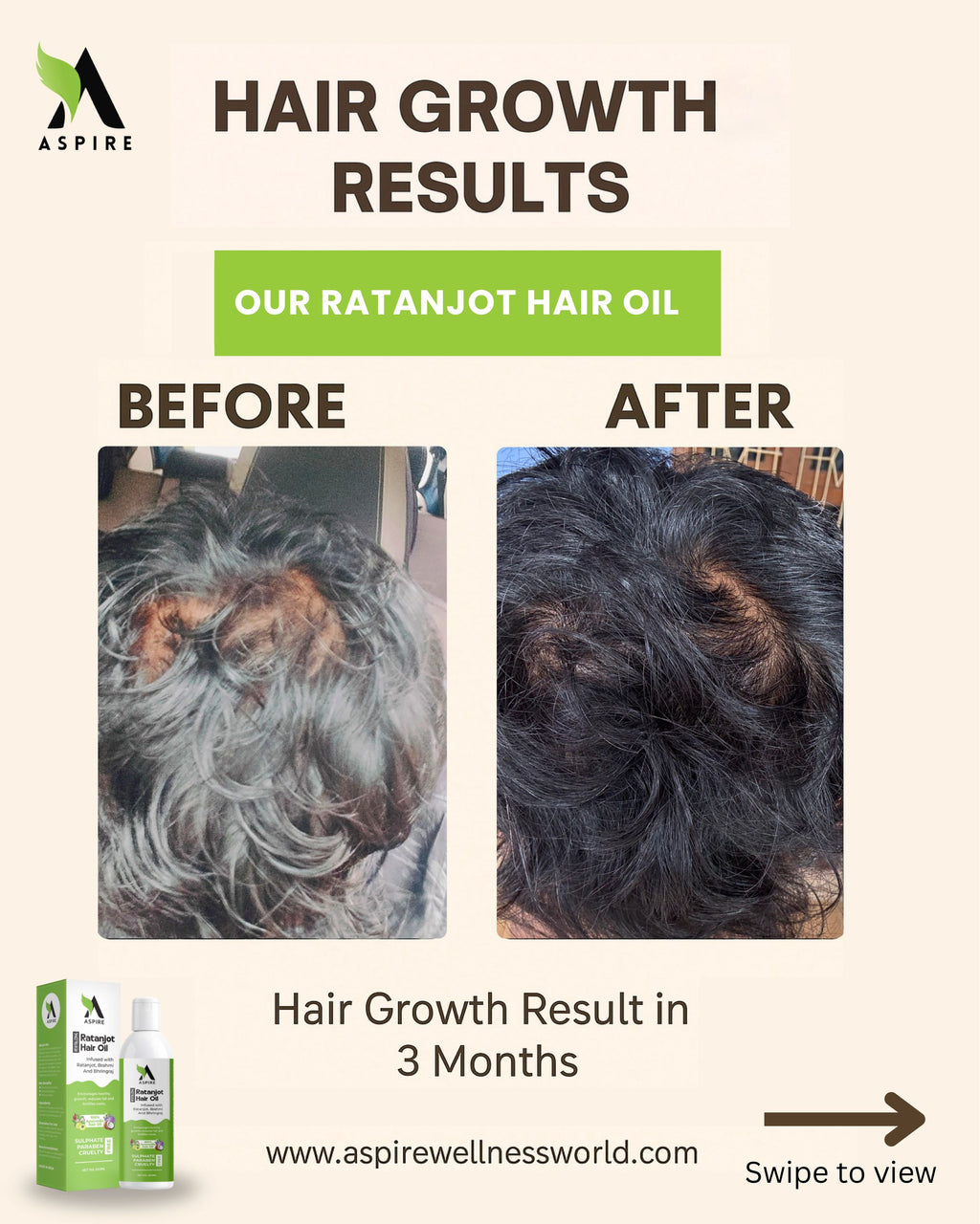 Aspire Wellness Hair Growth Oil 200ml