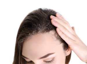 Dandruff